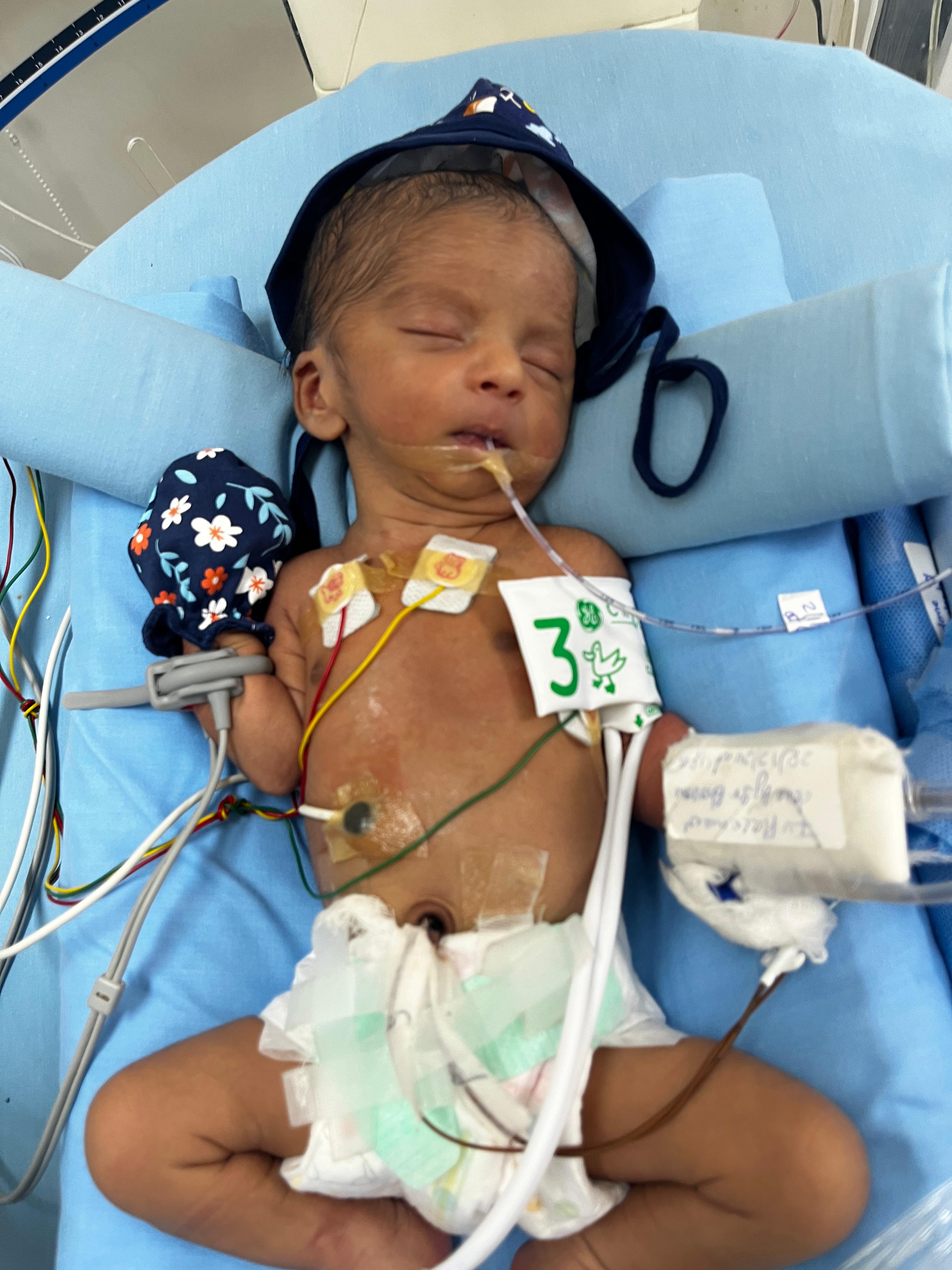 Help Save Baby of Bingi Navya